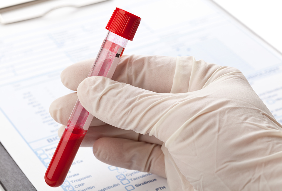 Blood-test_0